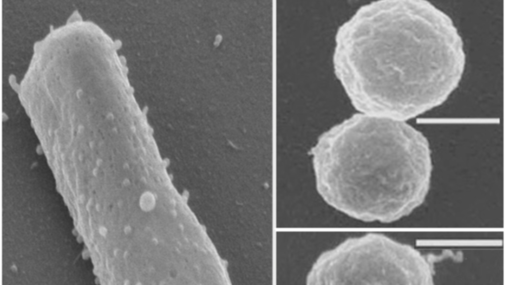 Halobacterium salinarum is an archaeon that thrives in extremely salty environments, like salt flats and brine pools. It uses a pigment called bacteriorhodopsin to convert sunlight into energy.