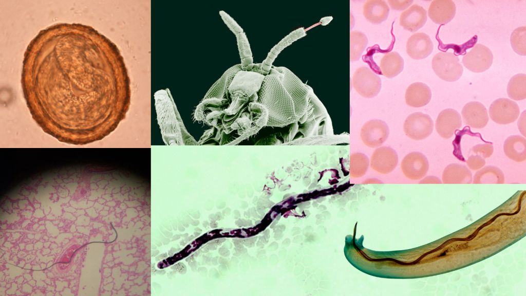 Parasites that can infect your brain
