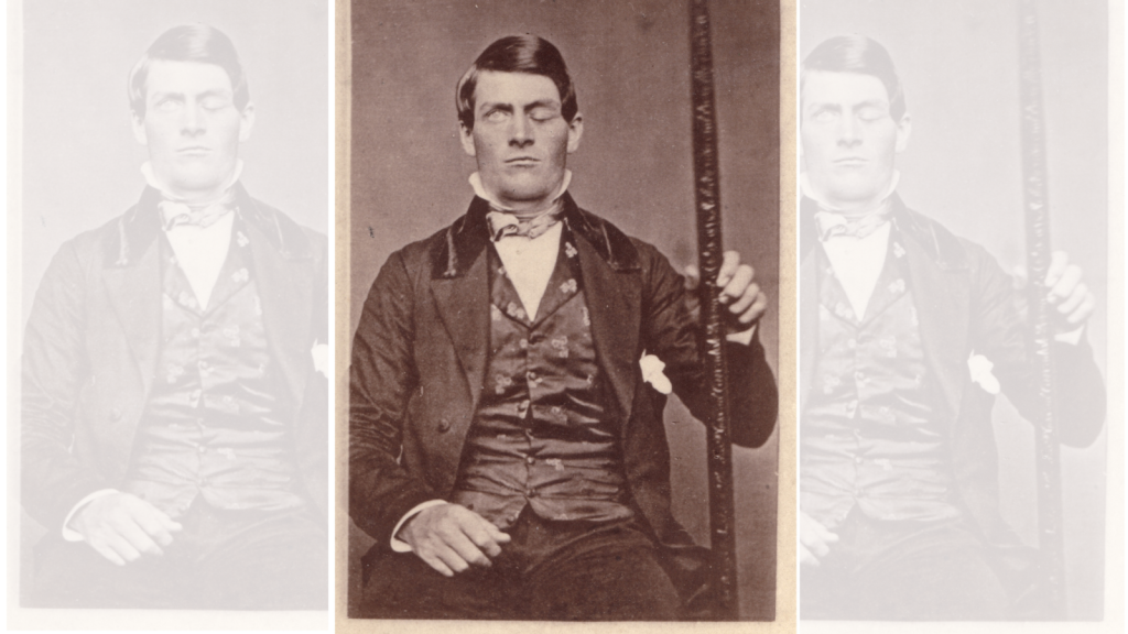 Phineas Gage