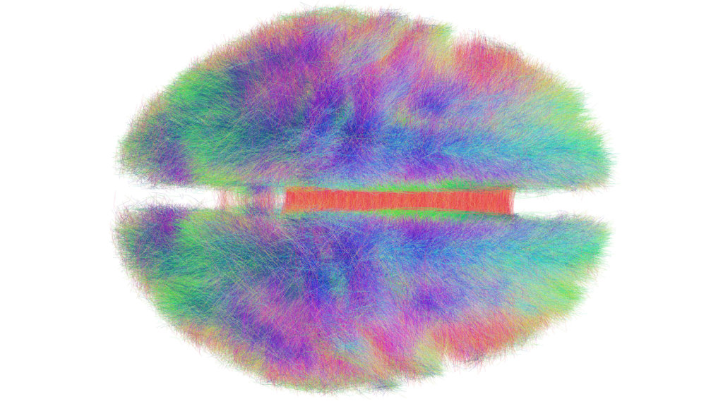 neural connections of the brain