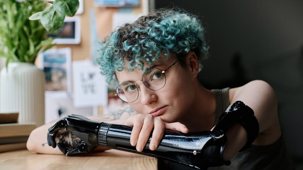 Woman with robotic prosthetic