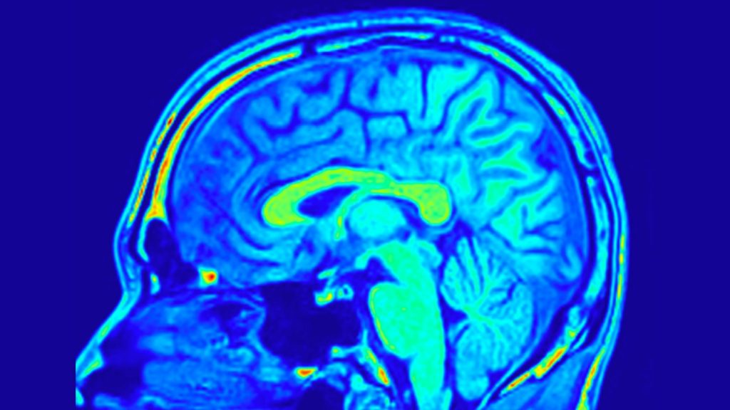 Sagital colorful Slice of Human Brain MRI surrounded with fluids